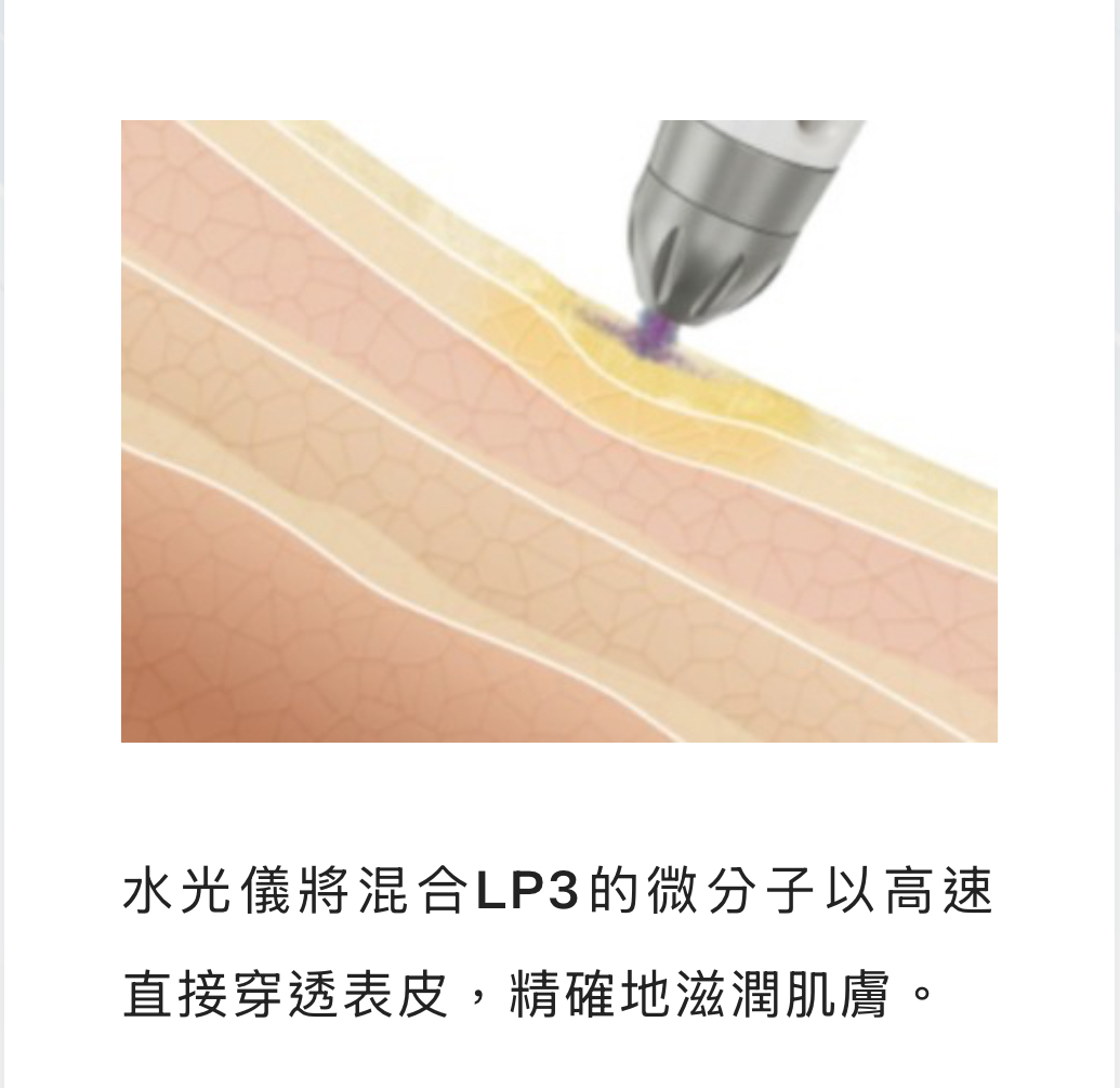 水光儀將混合LP3的微分子以高速-台中-緻己美學診所