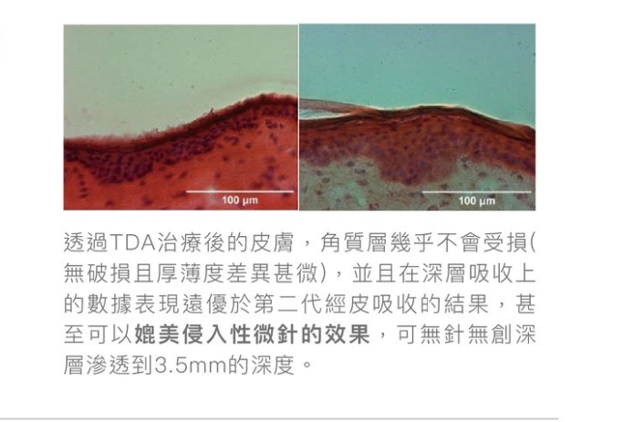透過TDA治療後的皮膚，角質層幾乎不會受損-台中-緻己美學診所