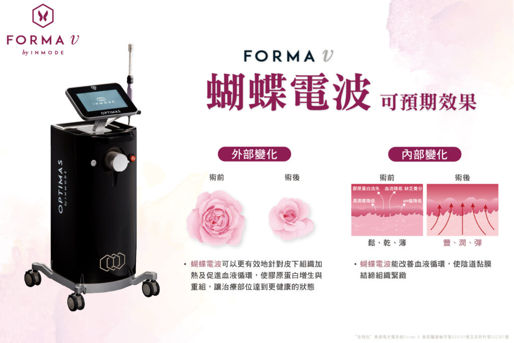 FORMAV-蝴蝶電波-效果-台中-緻己美學