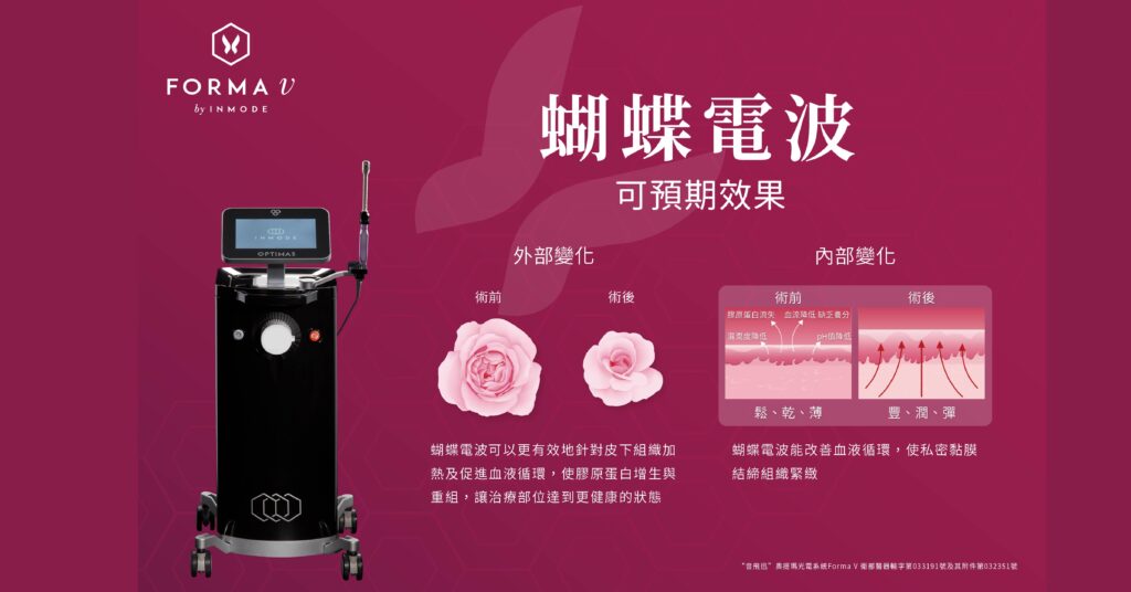 蝴蝶電波療程預期效果
