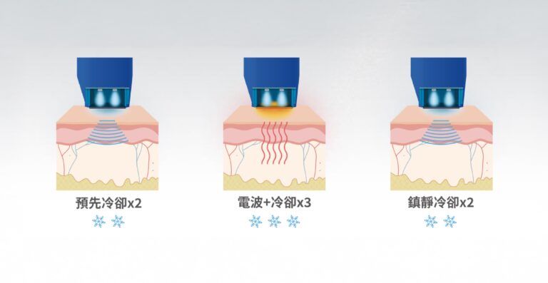黑色十蓓電波7段冷噴技術
