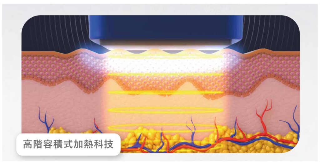 黑色十蓓電波高階容積式加熱科技